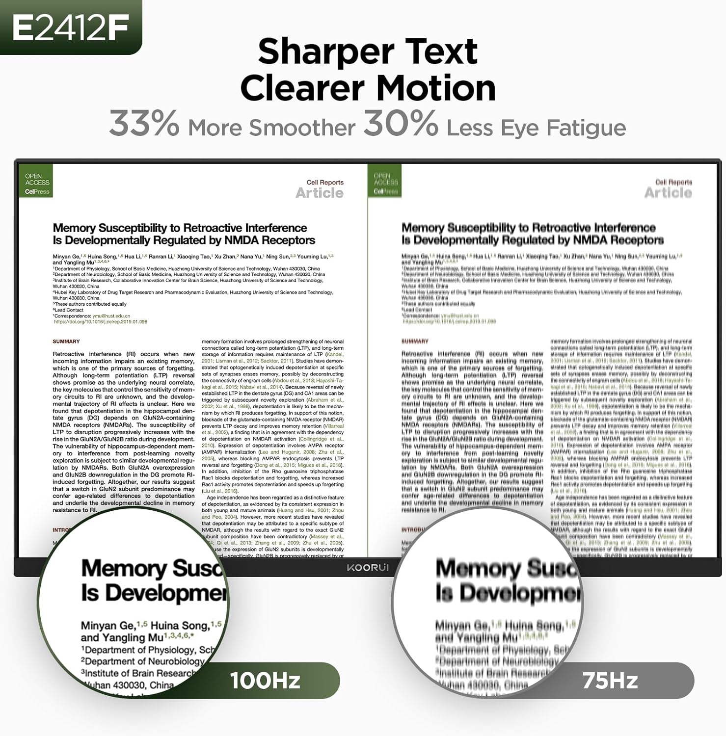 KOORUI 24-inch Computer Monitor Full HD 1920 x 1080p 100Hz VA Display 4000:1 Contrast Ratio with HDMI VGA, TÜV Rheinland Certified, 100 x 100 mm VESA Mountable, Ultra-Slim Design, Tilt, Black, E2412F